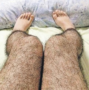 Волосатые ноги